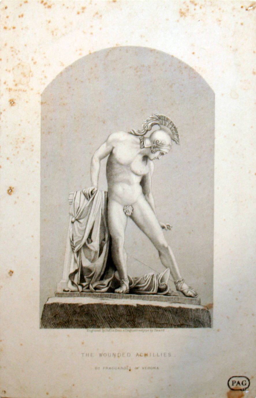 The Wounded Achilles
