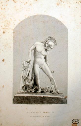 The Wounded Achilles